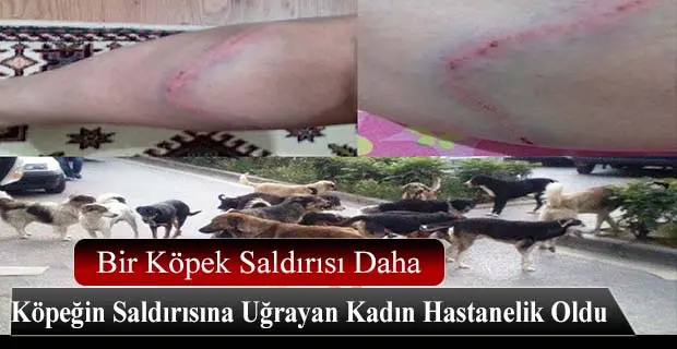 Haber: Kadın Hastanelik Oldu - Öne Çıkan
