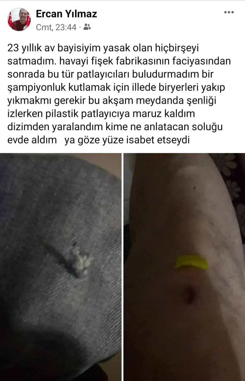 Haber: Patlayıcı ayağına saplandı - Galeri-1