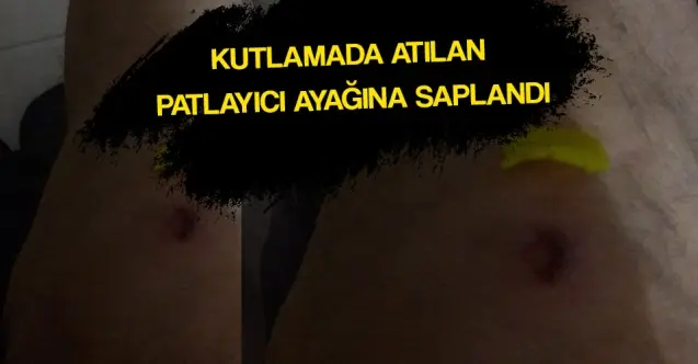 Haber: Patlayıcı ayağına saplandı - Öne Çıkan
