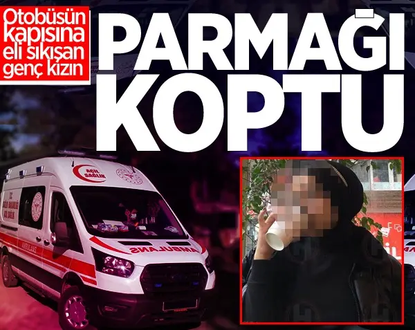 Haber: Genç kadının parmağı koptu - Öne Çıkan