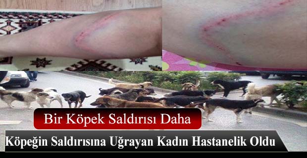 Kadın Hastanelik Oldu