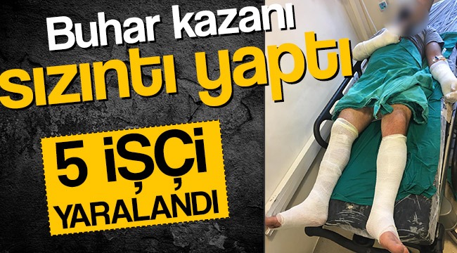 Beş İşçi Yanarak Yaralandı