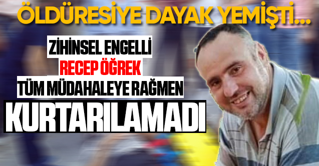 Darp Edilen Zihinsel Engelli Receb'i Kaybettik