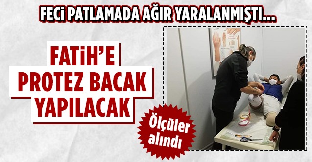 Fatih Protez bacak takılacak